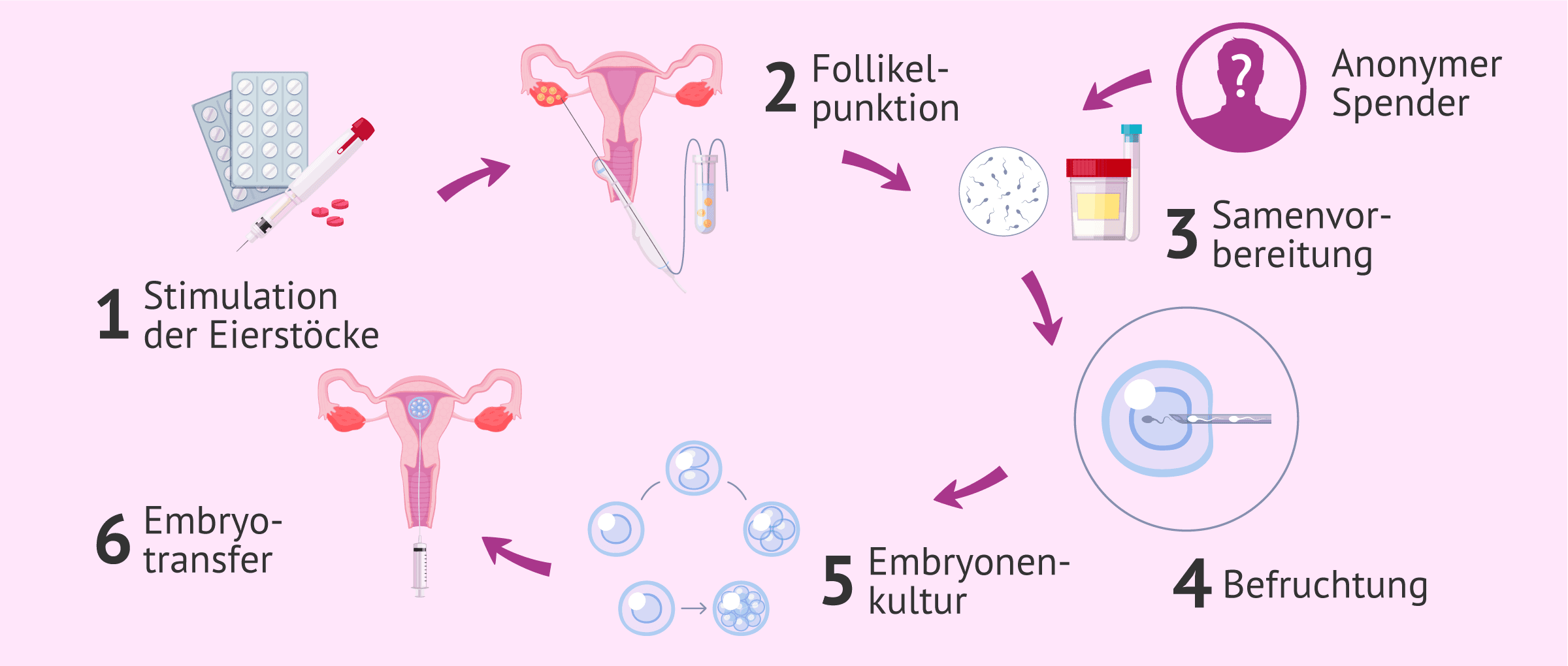 Imagen: Wie läuft der gesamte IVF-Prozess ab?
