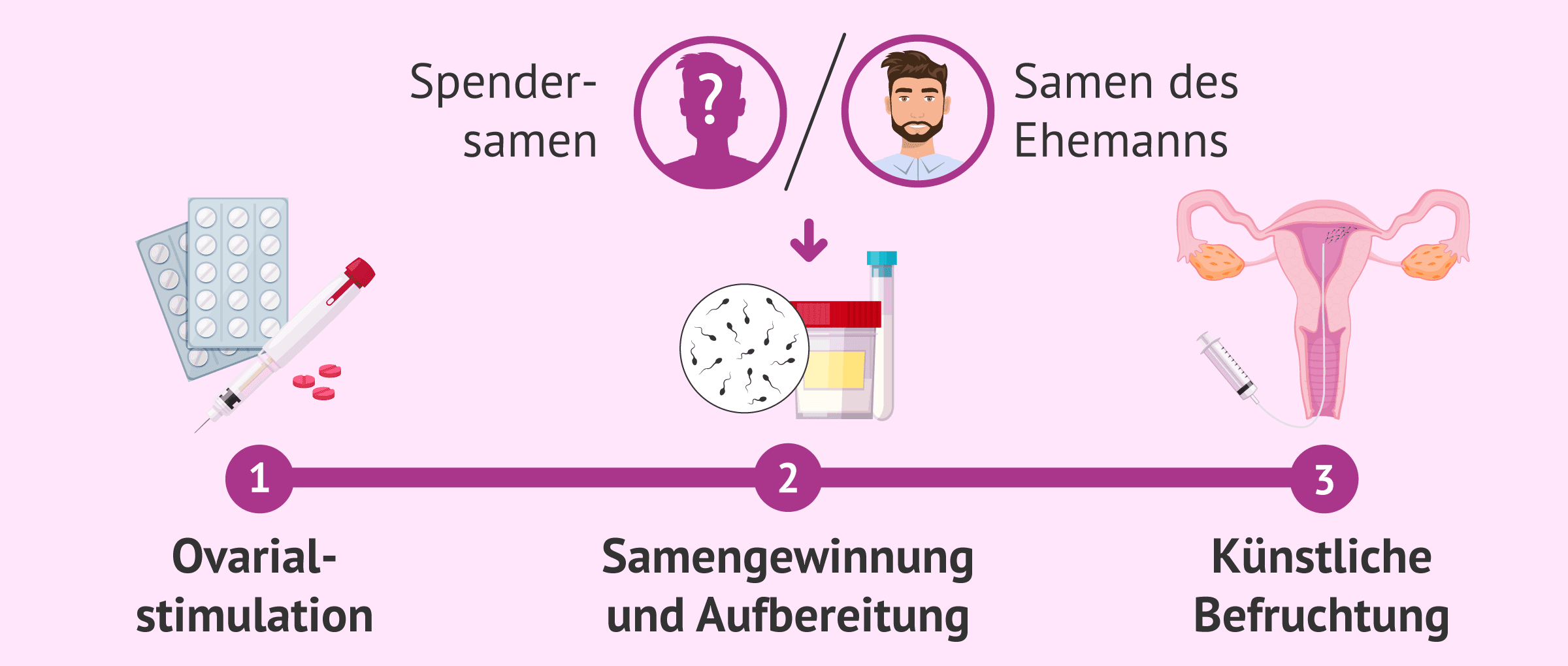 Imagen: Ablauf der KI mit Partner- oder Spendersamen