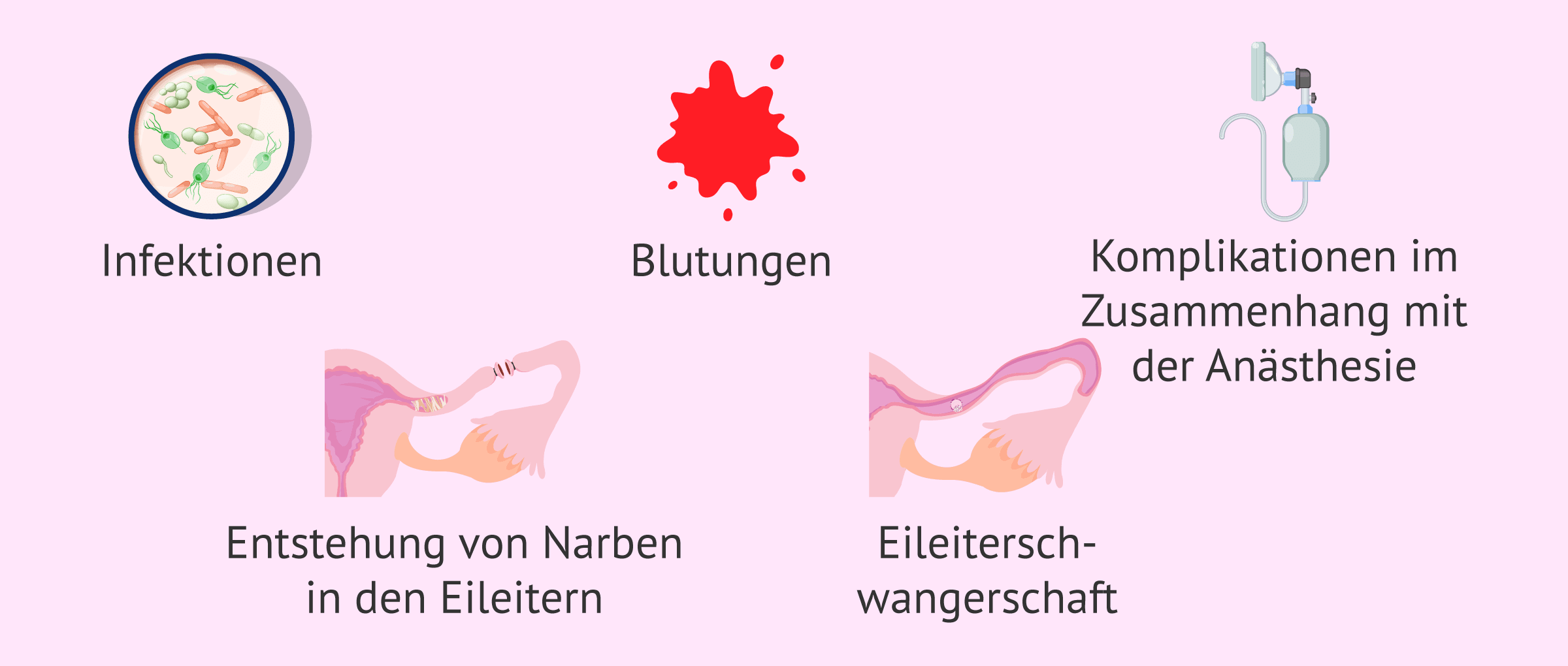Imagen: Risiken der Tuben-Rekanalisierung