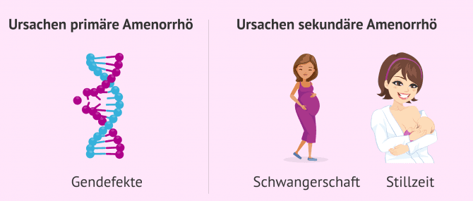 Imagen: Primäre und sekundäre Ursachen der Amenorrhö