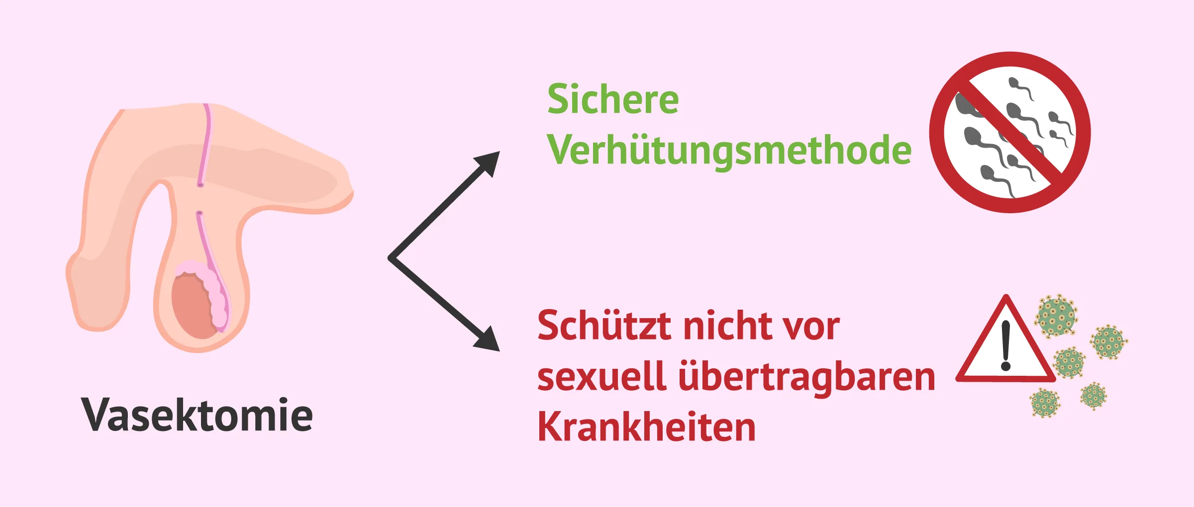 Die Vasektomie und ihre Auswirkungen