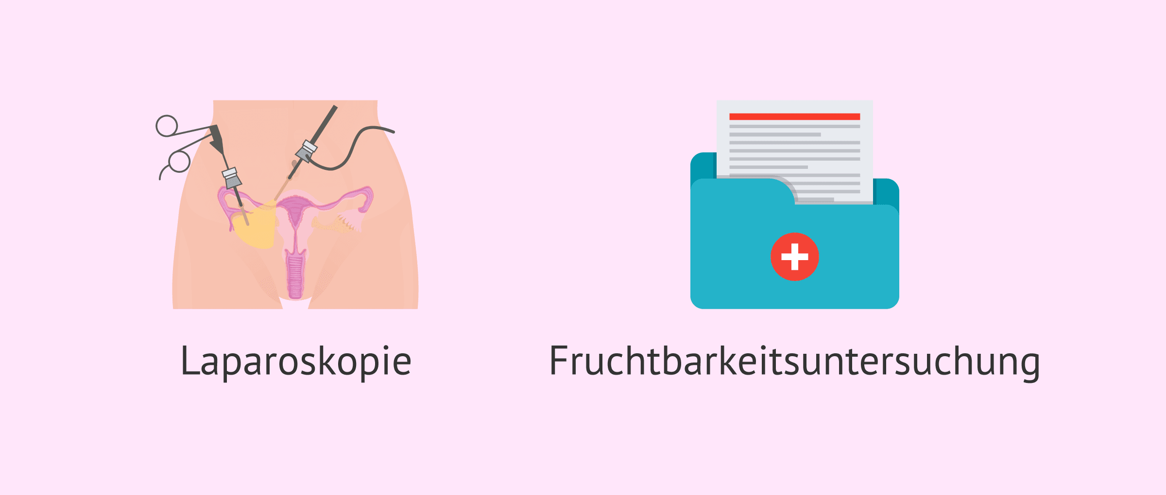 Imagen: Untersuchungen vor der Tuben-Refertilisierung