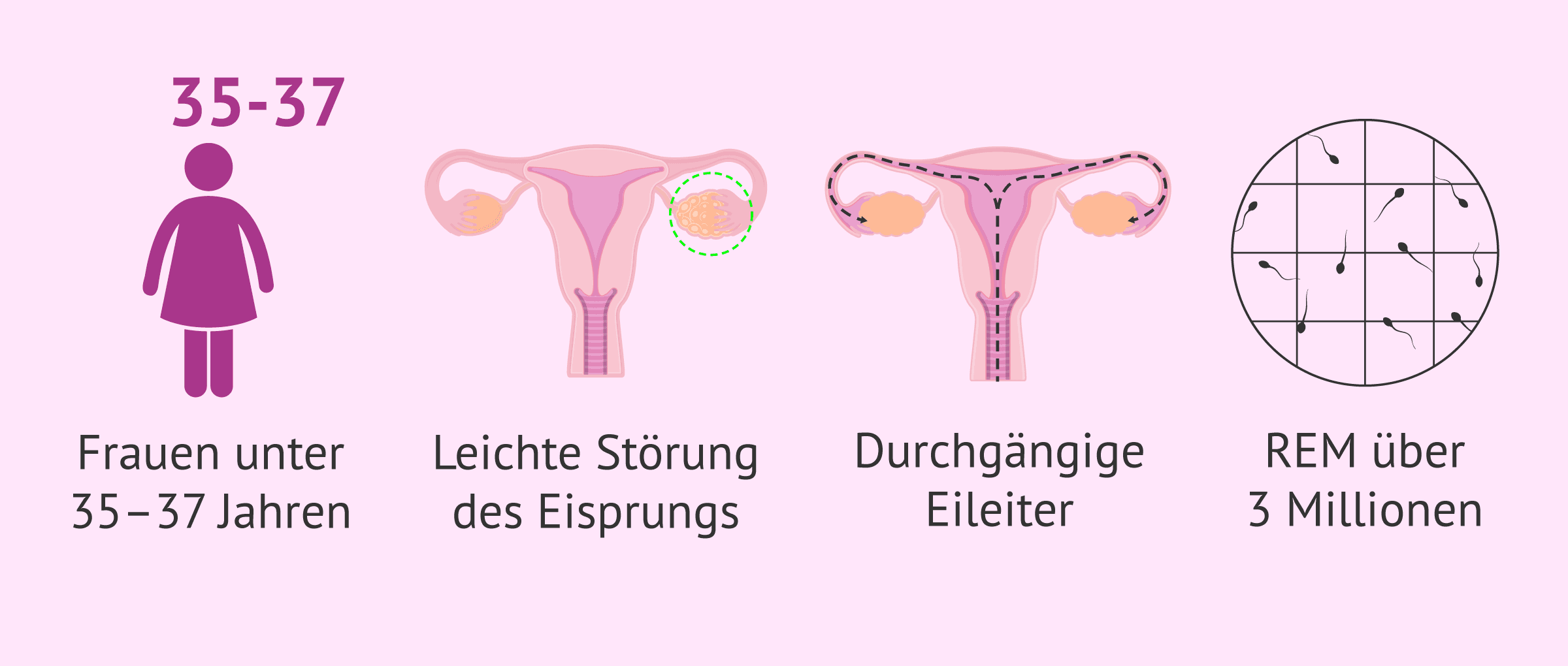 Imagen: Indikationen für die Insemination