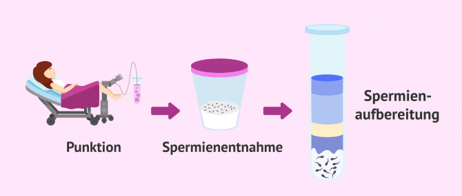 Imagen: Aufbereitung der Samenprobe