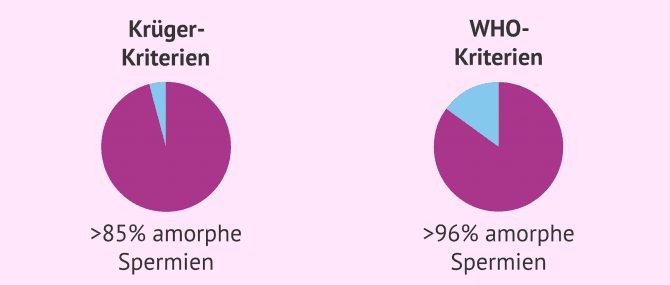 Imagen: Teratozoospermie nach den Kriterien von Kruger und WHO