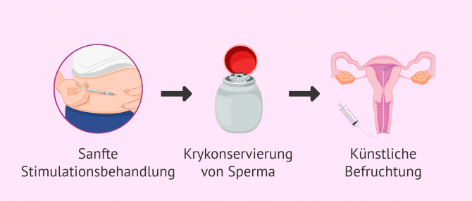 Imagen: Ablauf einer Insemination mit Spendersamen