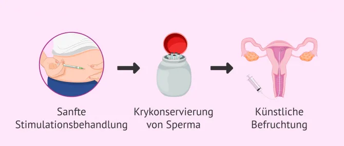 Heterologe Insemination: Ablauf, Kosten und Erfolgsraten