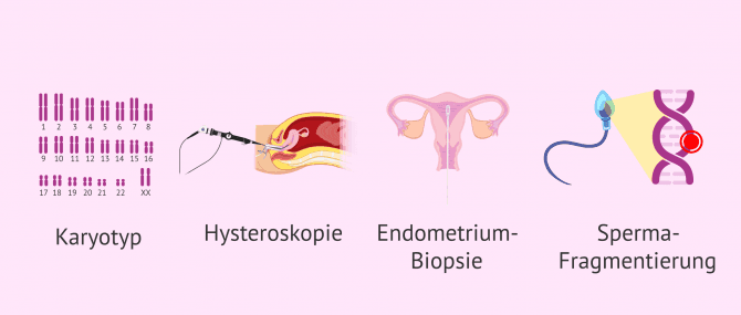 Imagen: Zusätzliche Tests bei der Fruchtbarkeitsuntersuchung