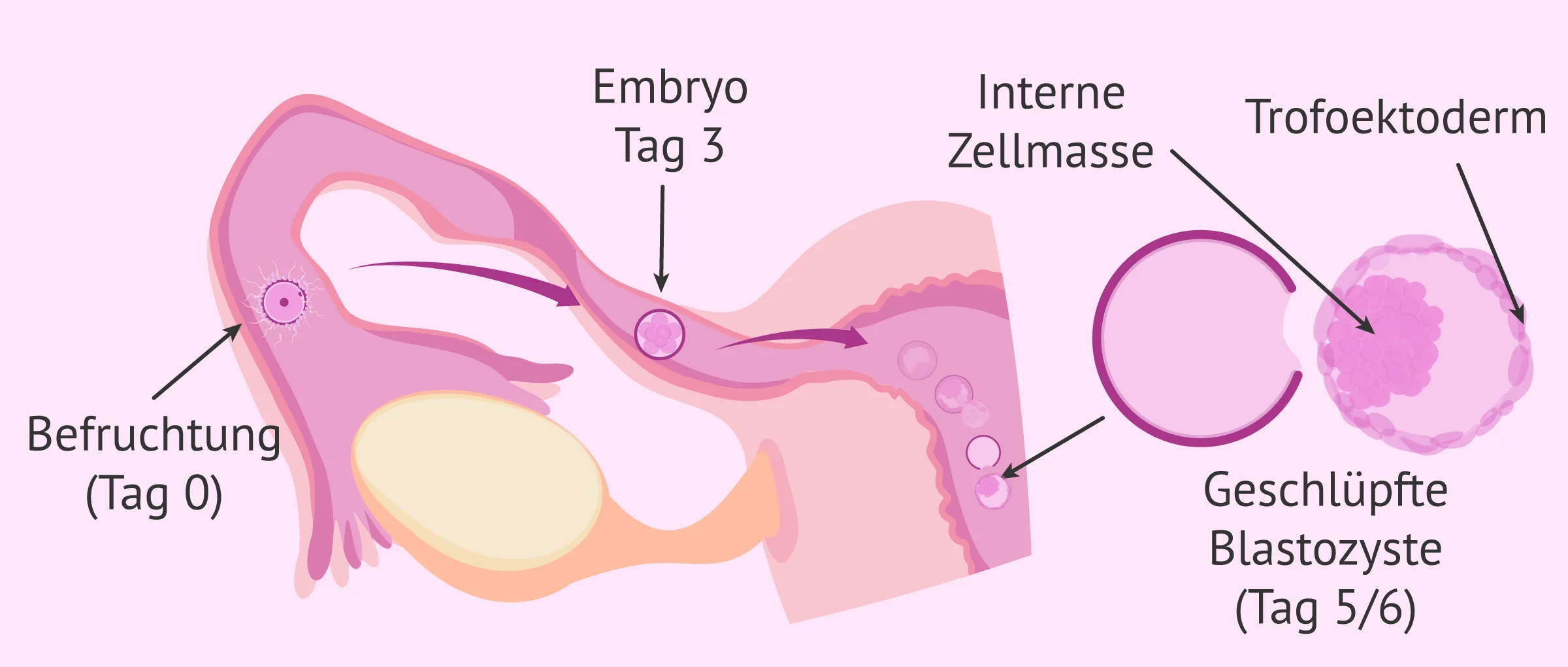 pflanztpfe 8 cm Stilvolle Mini-Blumentpfe in Grn & Rosa