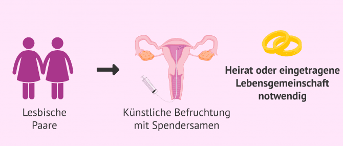 Imagen: Ehe oder eingetragene Lebensgemeinschaft bei heterologer Insemination