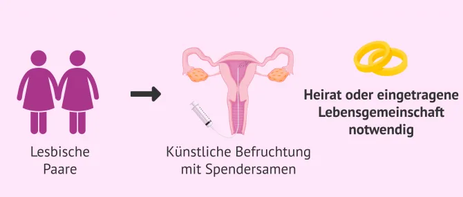 Heterologe Insemination: Ablauf, Kosten und Erfolgsraten