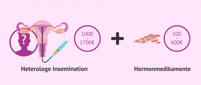 Imagen: Was kostet eine Insemination mit Fremdsperma?