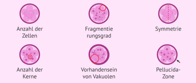 Imagen: Parameter zur Beurteilung der Embryonenqualität