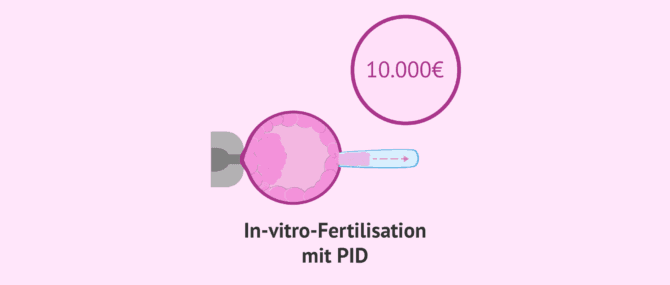 Imagen: Was kostet die DGP oder PGT?