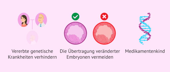 Imagen: Was sind die rechtlichen Aspekte der PID?