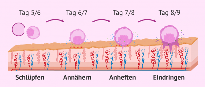 Imagen: Die verschiedenen Phasen der Embryoeinnistung