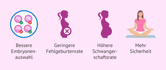 Imagen: Welche Vorteile bietet die PID?