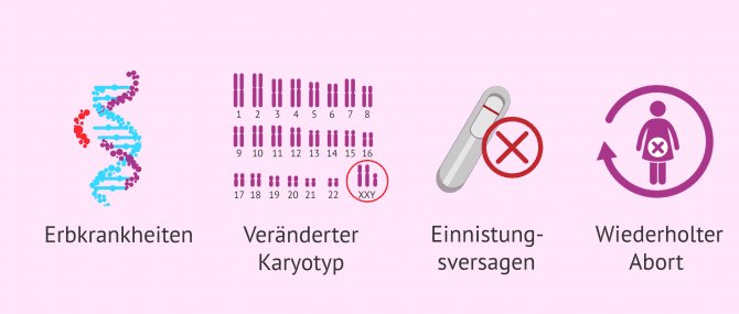 Imagen: Wann die PID angewendet wird