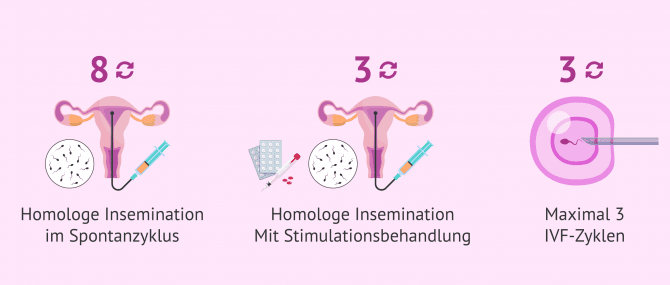 Imagen: Leistungen der Krankenkasse bei Kinderwunschbehandlungen