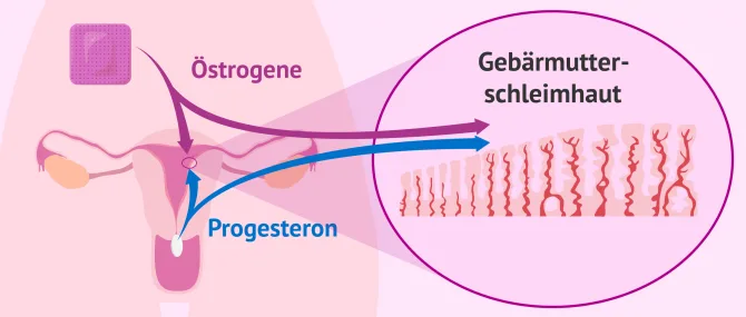 Imagen: Medikamenteneinnahme zum Aufbau der Gebärmutterschleimhaut