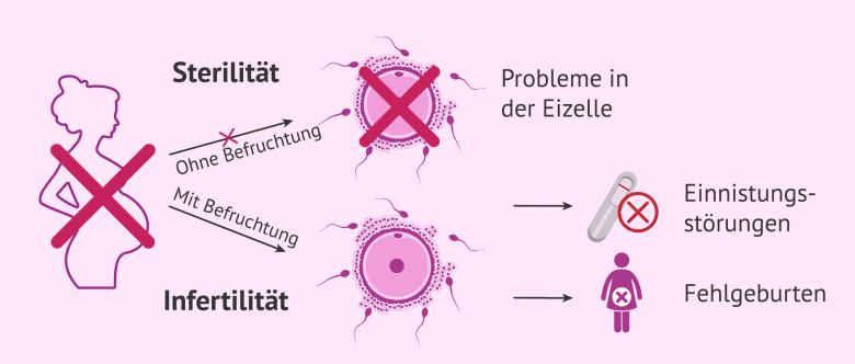 Schwanger Trotz Sterilisation Der Frau www.invitra.de