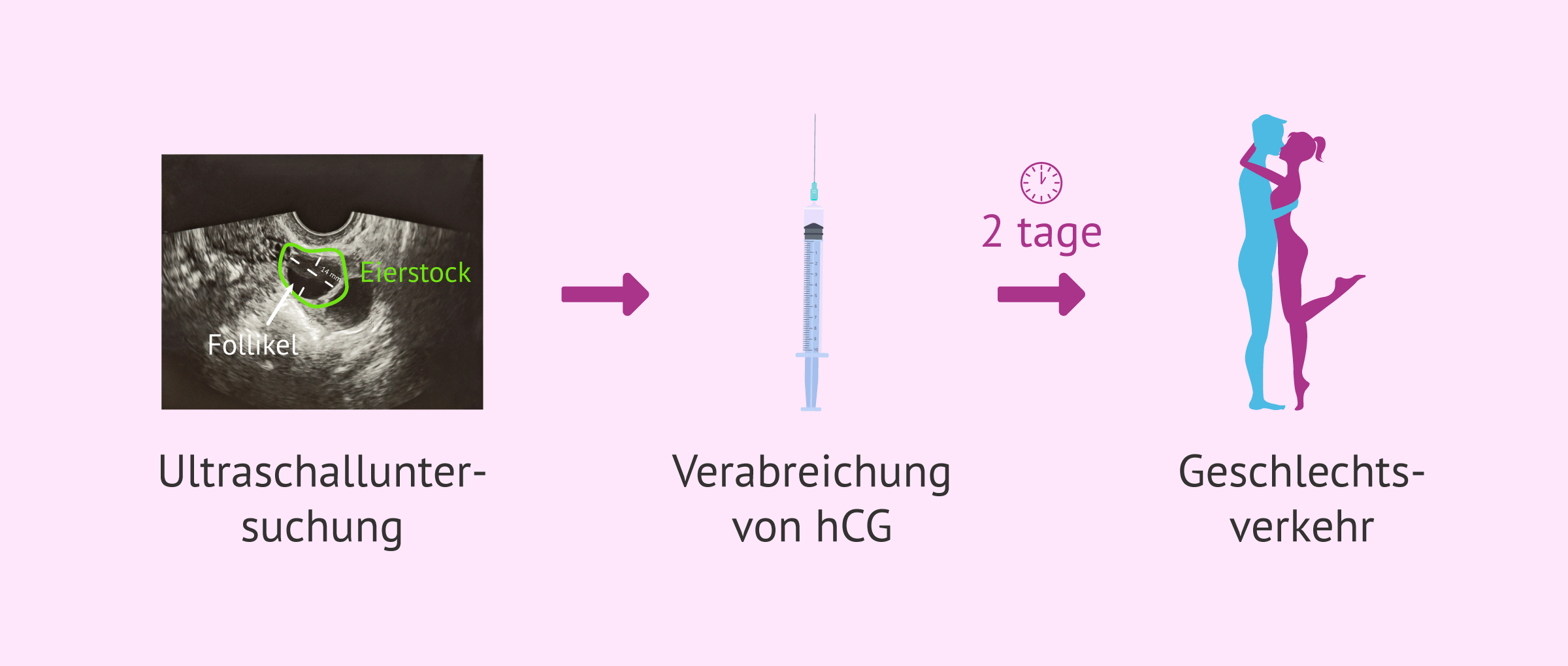 Imagen: Protokoll für Verkehr nach Plan mit Ovulationsinduktion