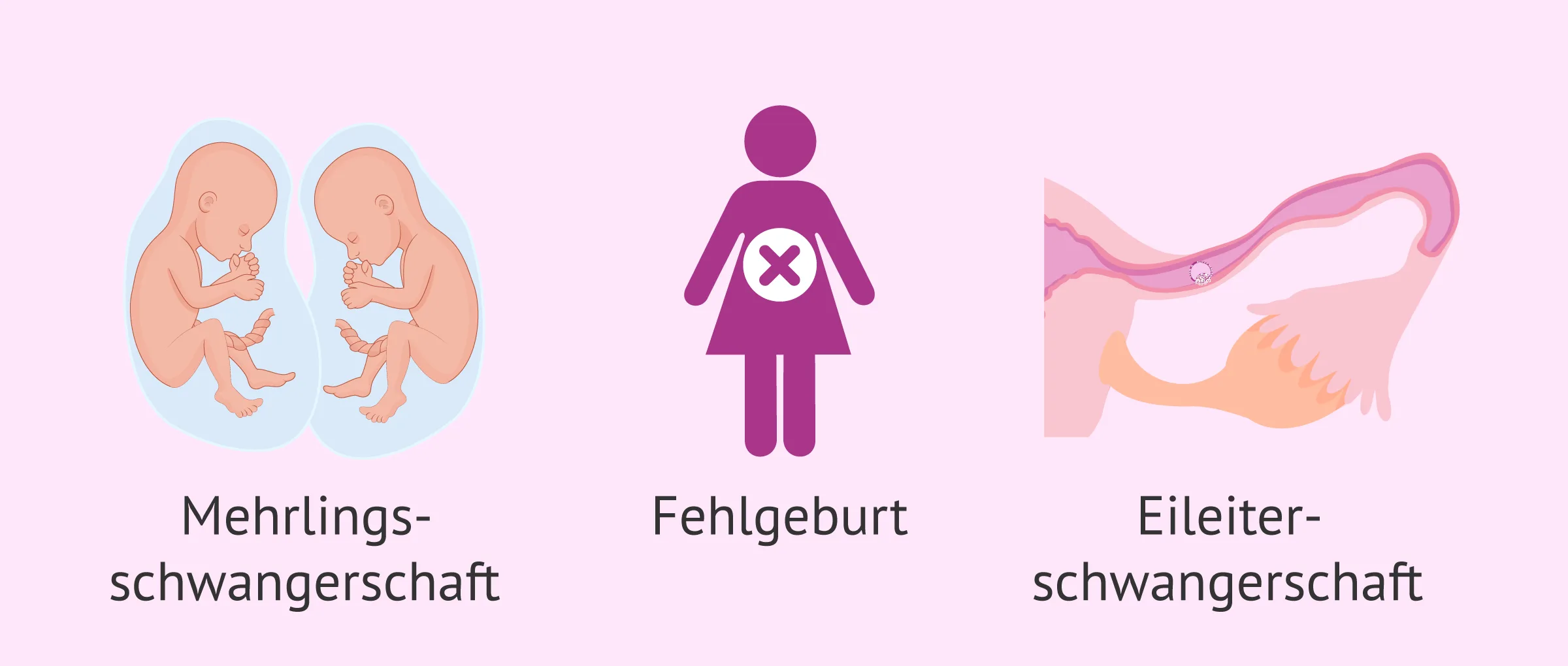 Risiken in der künstlichen Befruchtung (IVF) für Mutter & Kind