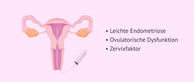 Imagen: Künstliche Befruchtung (AI) und weibliche Unfruchtbarkeit