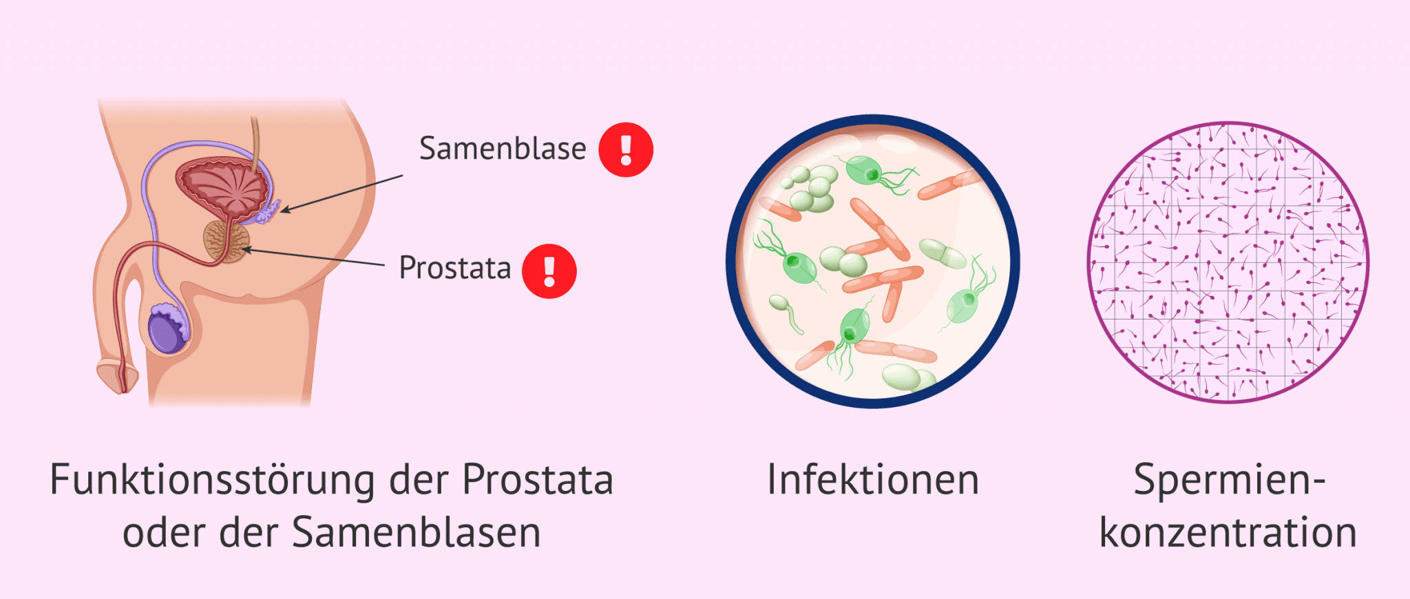 Wie beeinflusst die Spermadichte die Fruchtbarkeit?