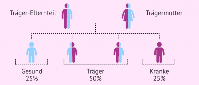 Imagen: Wie sieht die autosomal-rezessive Vererbung aus?