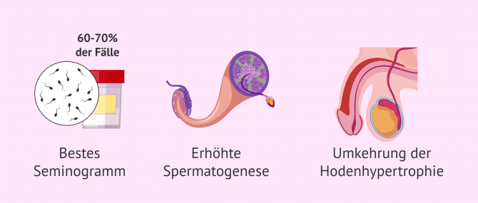 Imagen: Folgen der Varikozele auf die Fruchtbarkeit