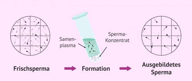 Imagen: REM Samenogramm Ergebnisse