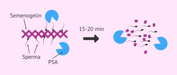 Imagen: Spermadichte und Verflüssigung