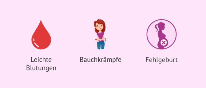 Imagen: Welche Risiken birgt das endometriale Scratching?