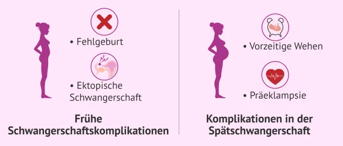 Wie kann ich mit Endometriose schwanger werden?