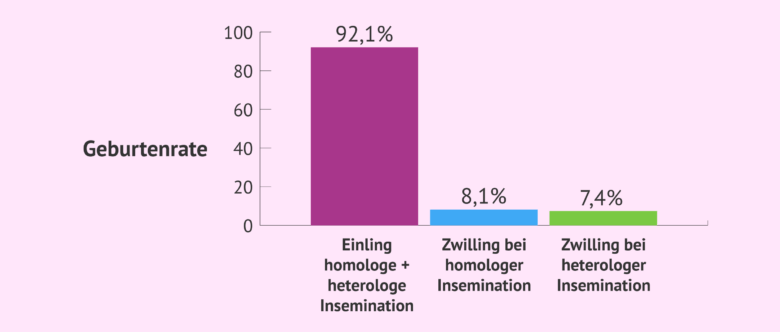 Die Wahrscheinlichkeit Einer Jungengeburt Beträgt Ca 50 Wahrscheinlichkeit von Zwillingen bei IVF und künstlicher Befruchtung