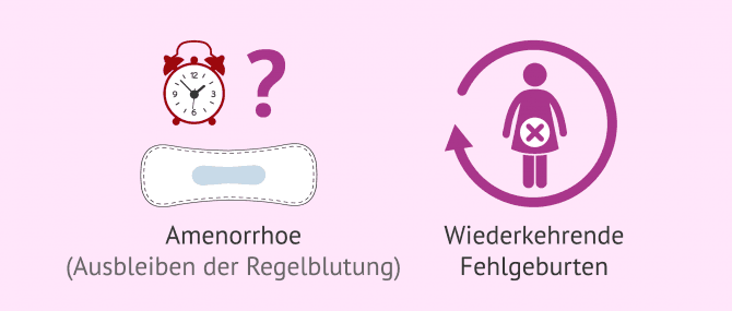 Imagen: Wie wird die Säuglingsmatrix diagnostiziert?