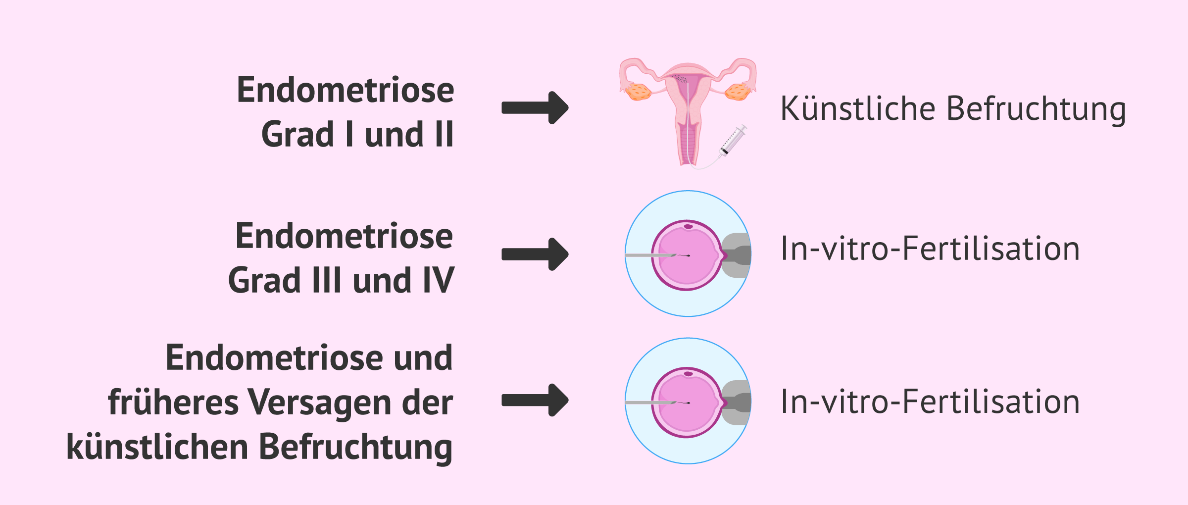 Endometriose und Fruchtbarkeitsbehandlung