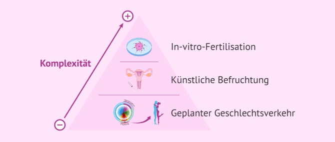 Imagen: Techniken der assistierten Reproduktion von geringer bis hoher Komplexität
