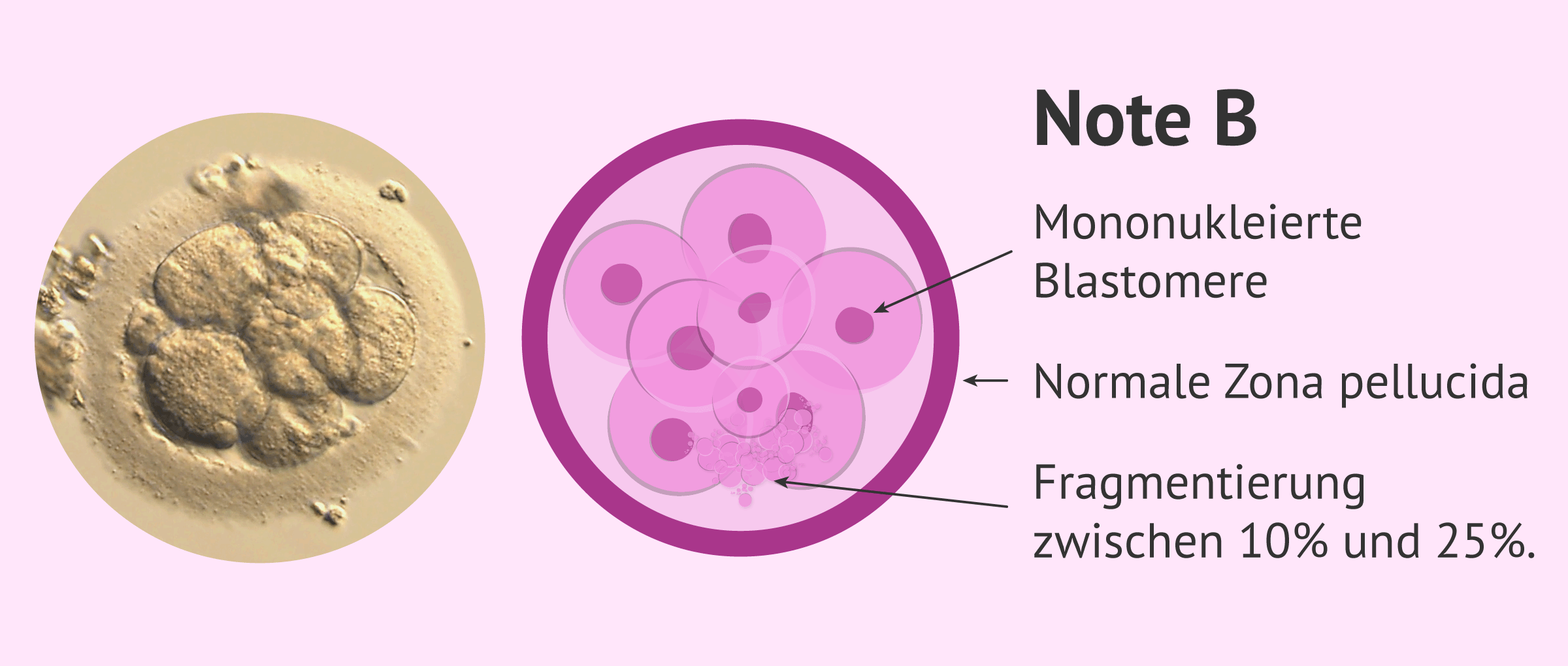 Imagen: Embryoqualität: Klasse B