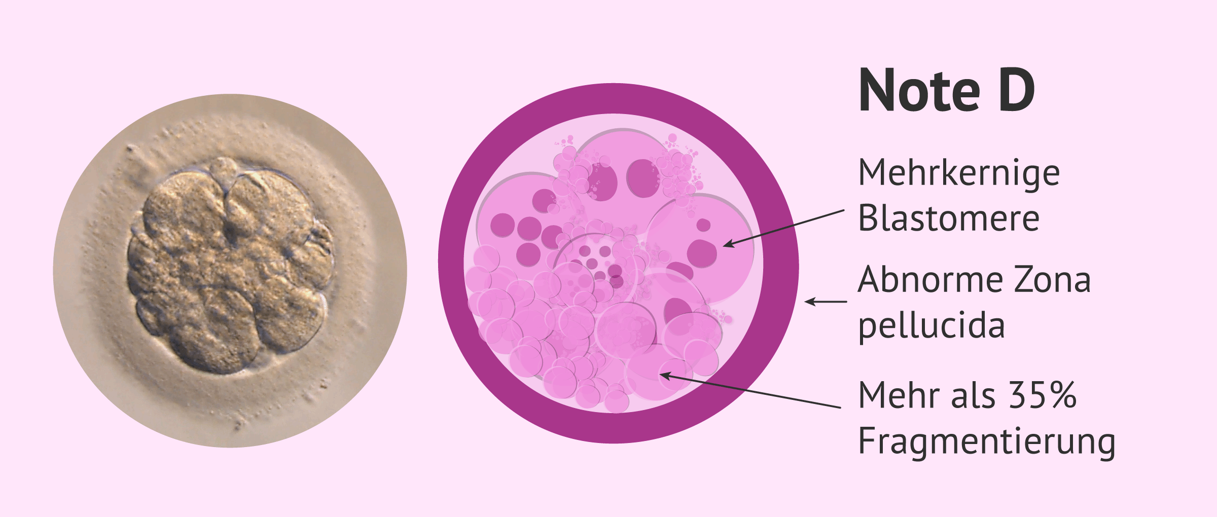 Imagen: Embryoqualität: Klasse D