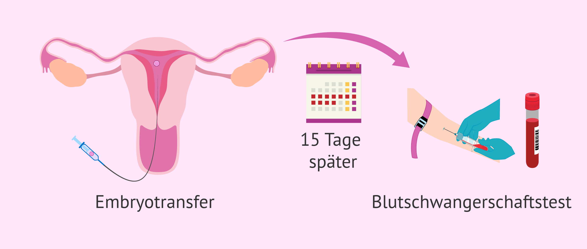Imagen: Wann sollte man nach einer IVF einen Schwangerschaftstest machen?
