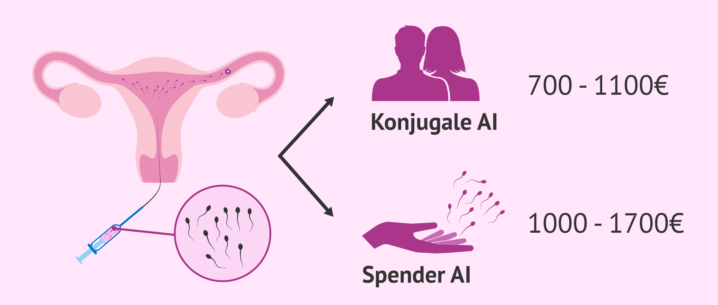 Imagen: Preis der künstlichen Befruchtung durch Ehegatten und Spender