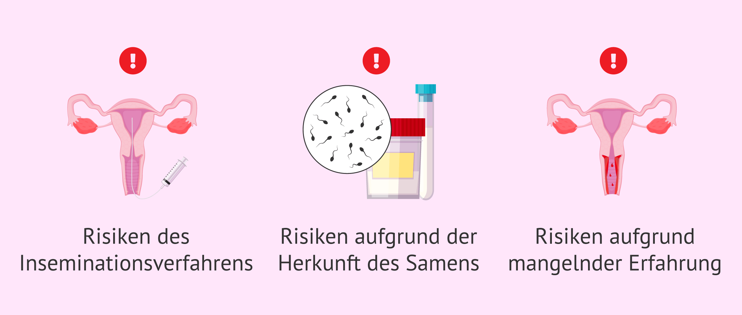 Imagen: Probleme bei der Durchführung der künstlichen Befruchtung zu Hause