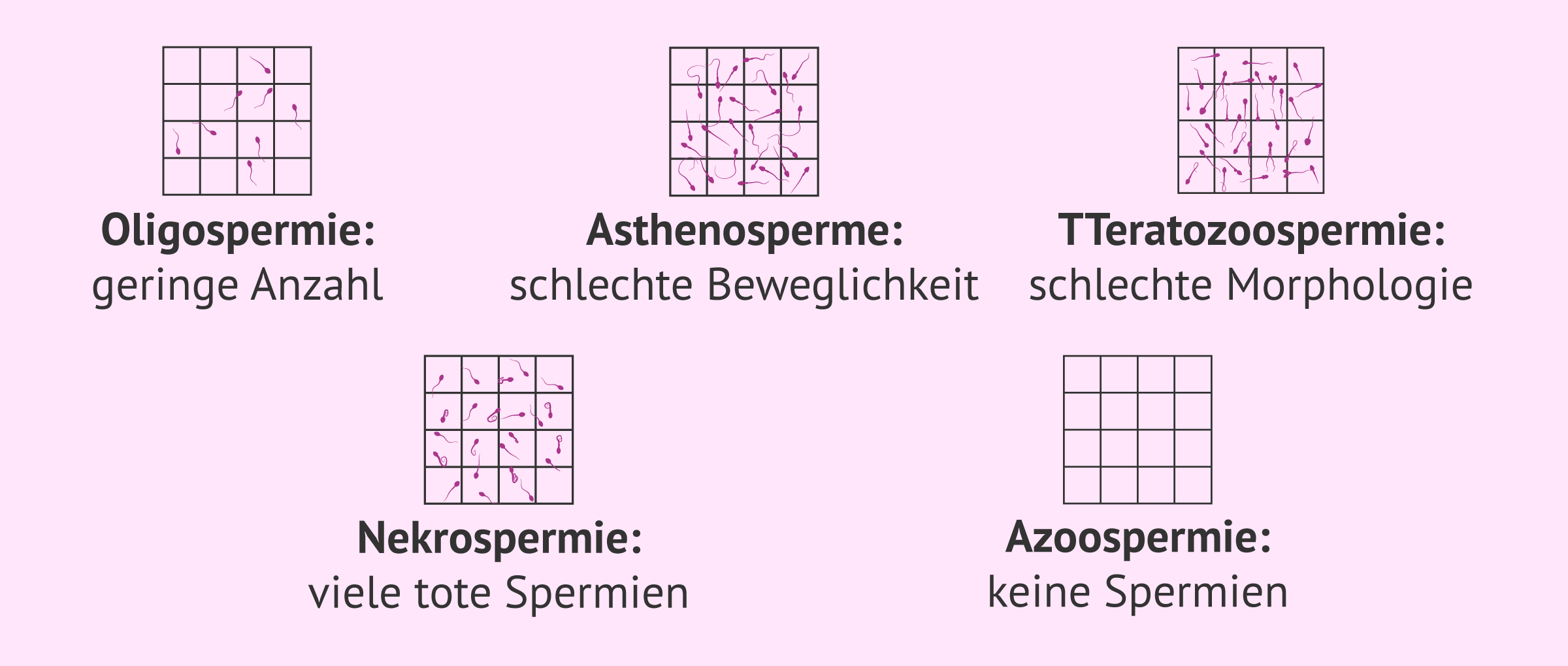 Imagen: Spermatische Ursache der Unfruchtbarkeit beim Mann