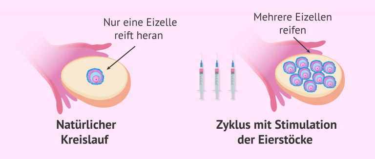 beeinflusst-die-stimulation-der-eierst-cke-die-qualit-t-der-embryonen