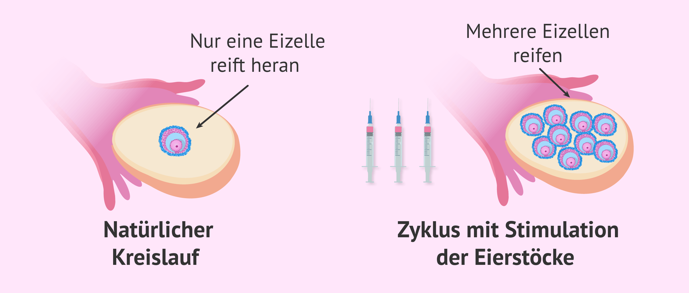Imagen: Natürliche vs. stimulierte Eizellreifung