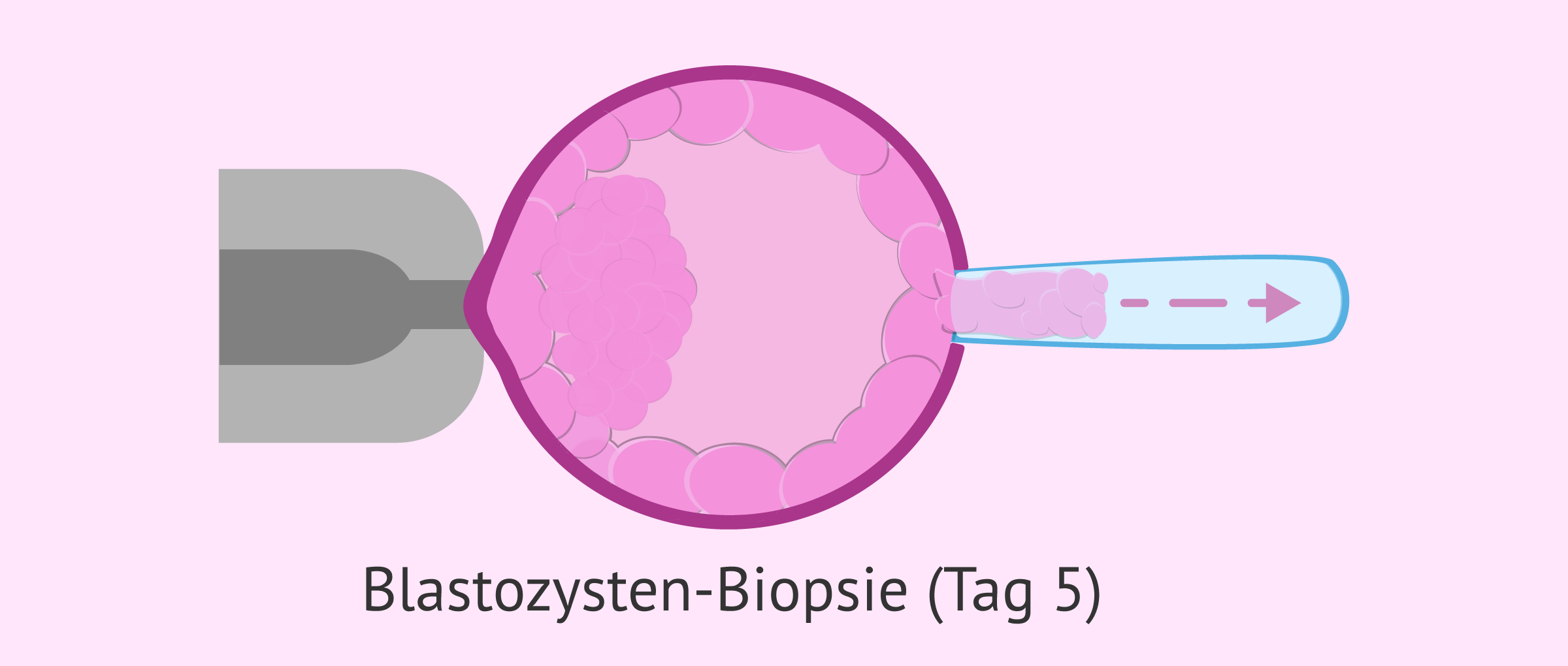 Tag 5 Trophoestoderm-Biopsie