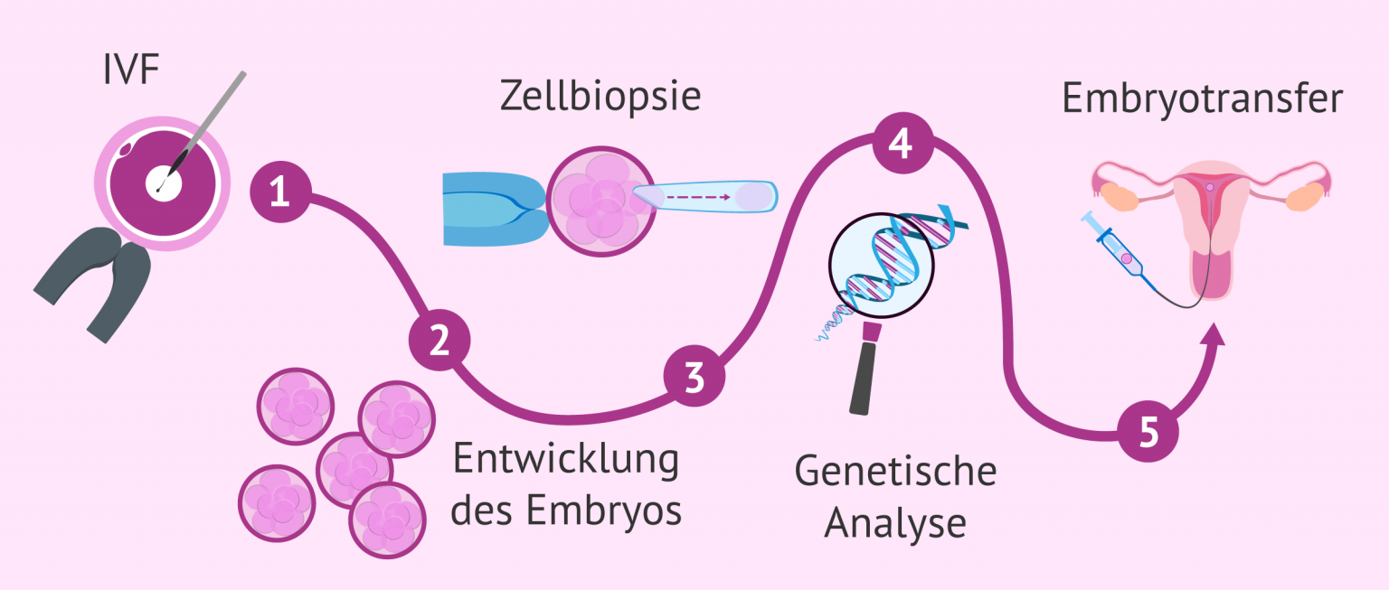 Wie wird eine PID Schritt für Schritt durchgeführt?