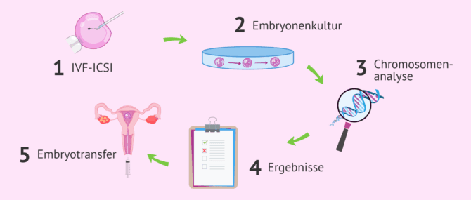 Imagen: Verfahren des nicht-invasiven Präimplantations-Gentests oder Embrace-Tests
